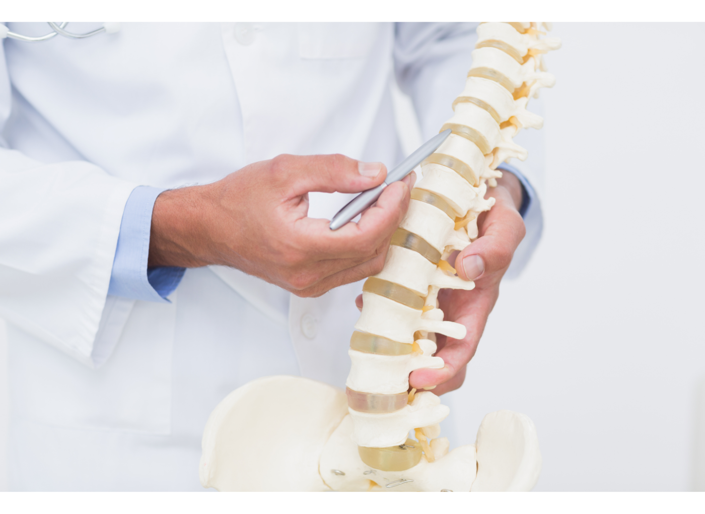 spondylosis