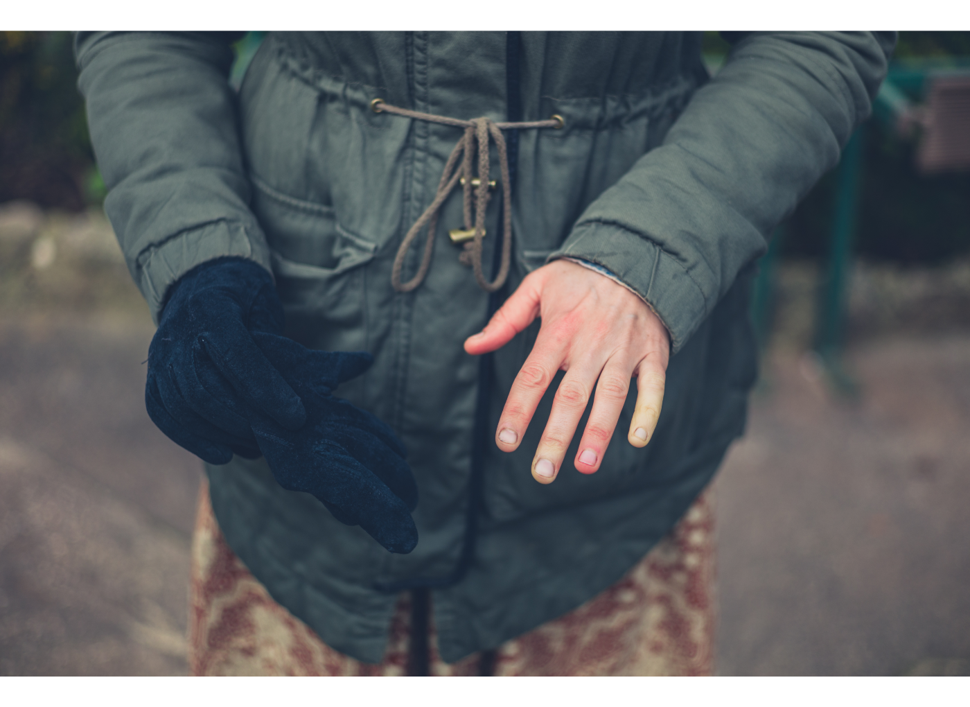 Raynaud-szindróma: gyógytornász válaszol