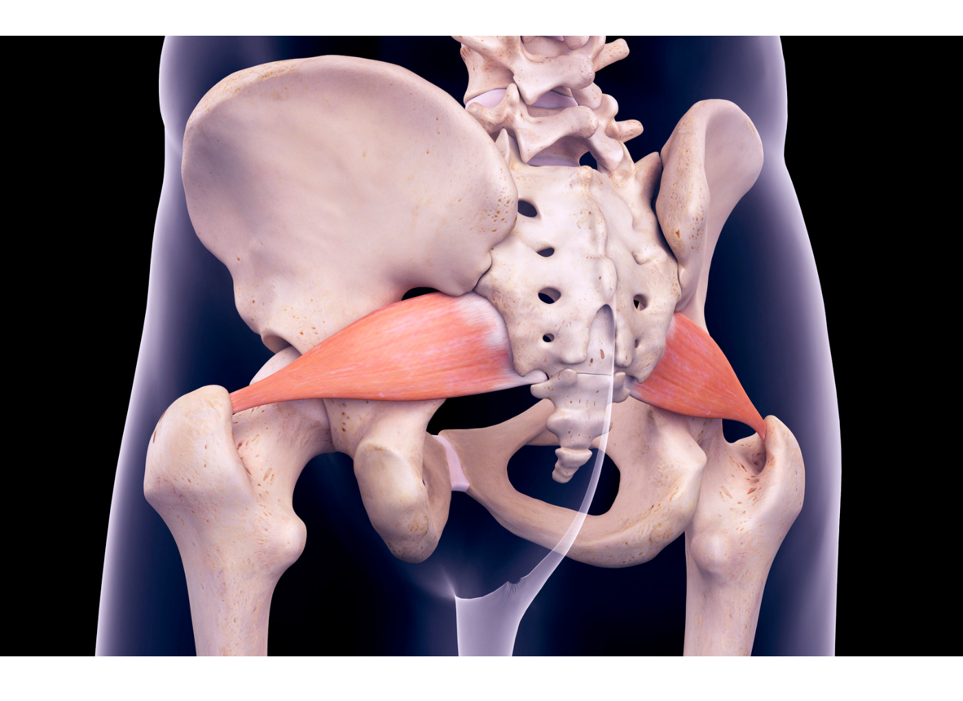 Piriformis szindróma gyógytornája – minden, amit tudni érdemes